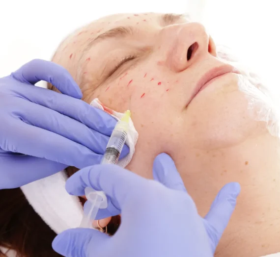 Mezoterapia igłowa Lublin