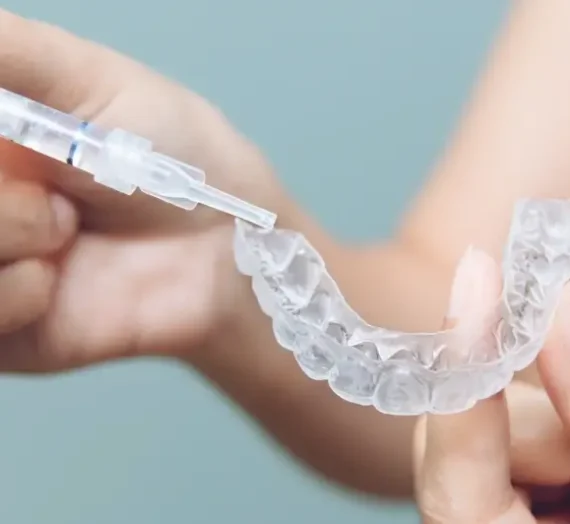 Aparat Invisalign