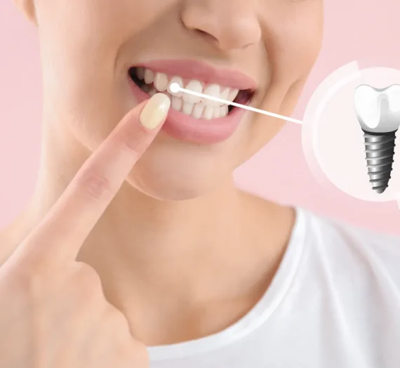 Ile wytrzymują implanty zębowe?