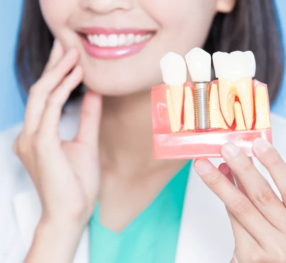 Implanty zębów cała szczęka cena Lublin