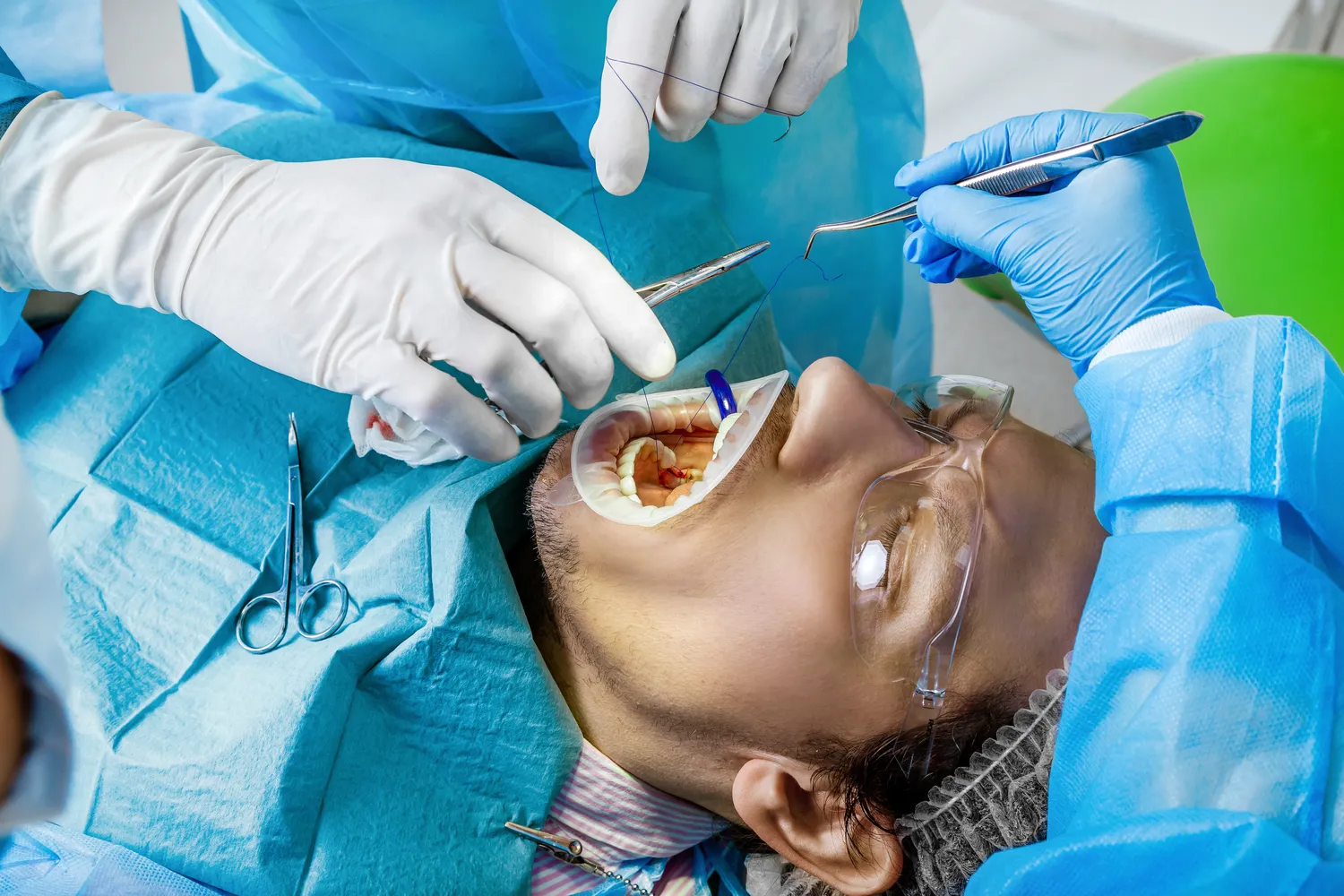 Implanty zębów cała szczęka cena Lublin