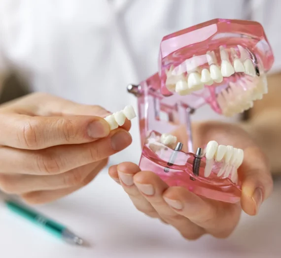 Implanty stomatologiczne