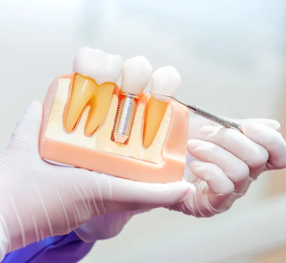 Implanty stomatologiczne Szczecin