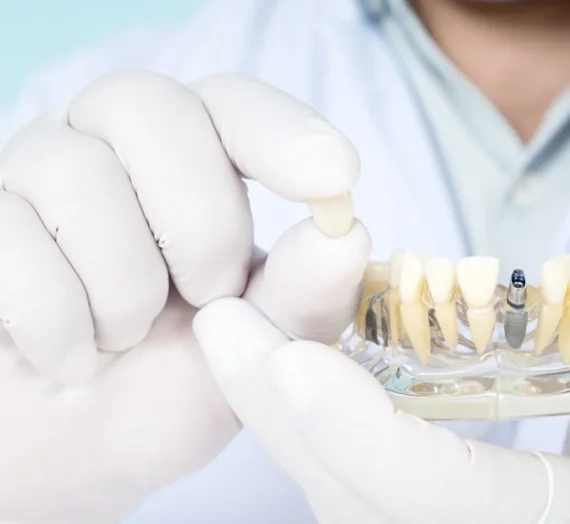 Implanty stomatologiczne Warszawa