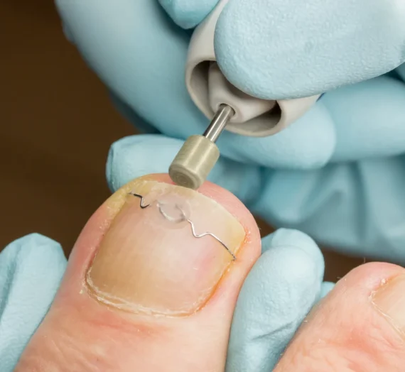 Leczymy stopy, czyli wizyta u podologa