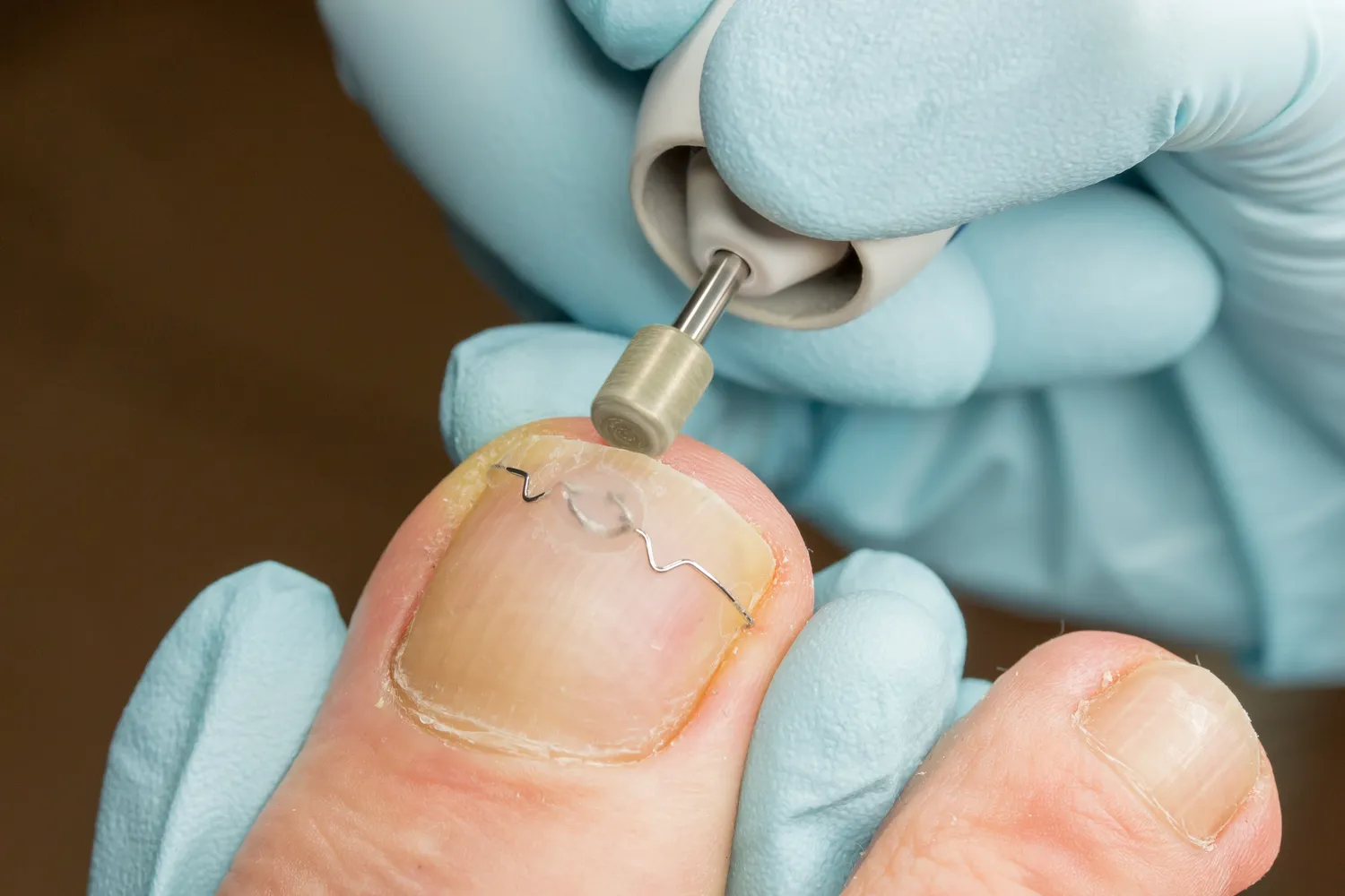 Pedicure leczniczy Szczecin