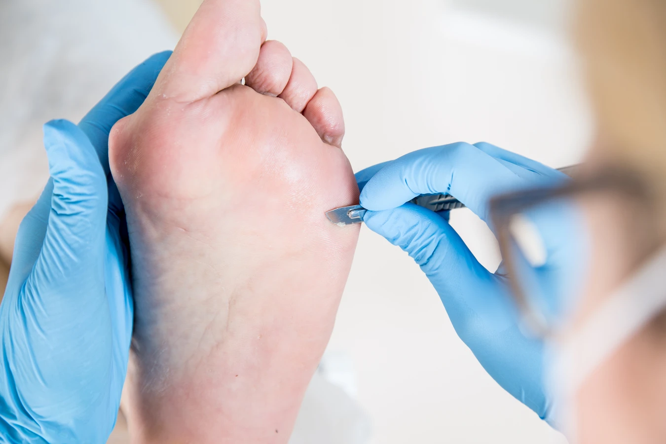 Pedicure leczniczy Warszawa