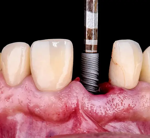 Endodoncja ranking Szczecin