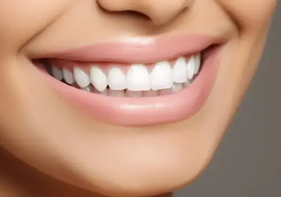 Licówki jak się zakłada?