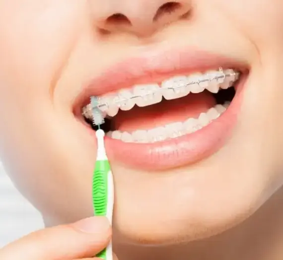 Licówki ranking Szczecin