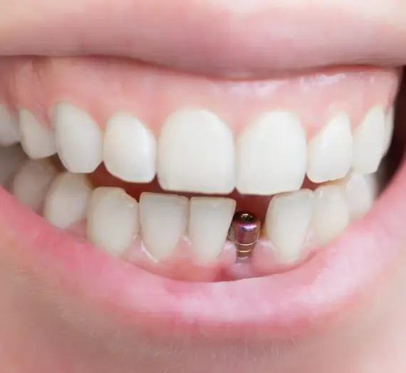 Najlepsza endodoncja Szczecin