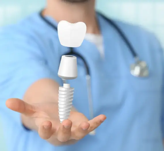 Bezśrubowe implanty co to?