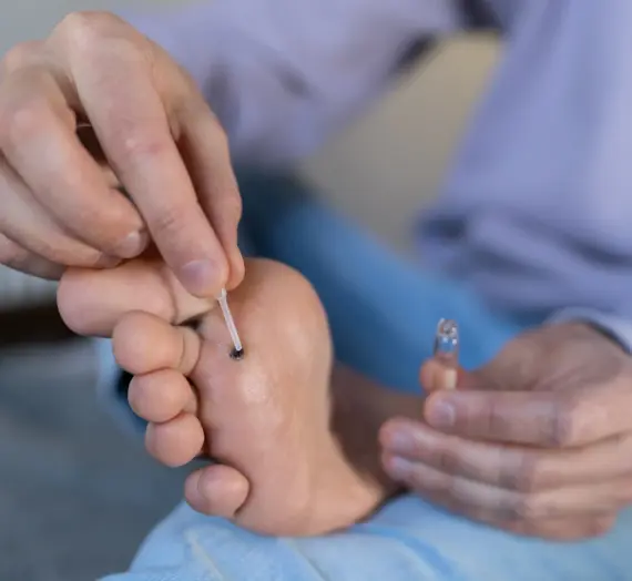 Co na brodawki i kurzajki?