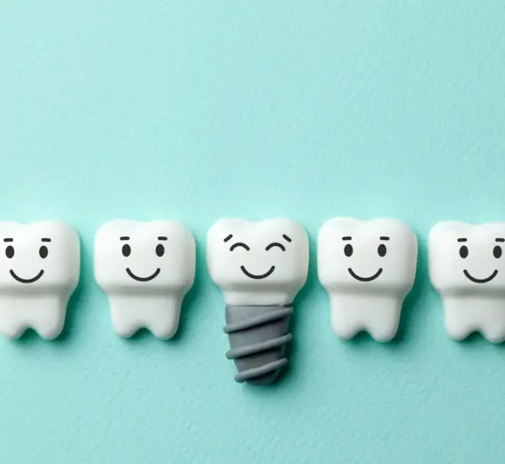 Czy warto zdecydować się na implanty zębowe?