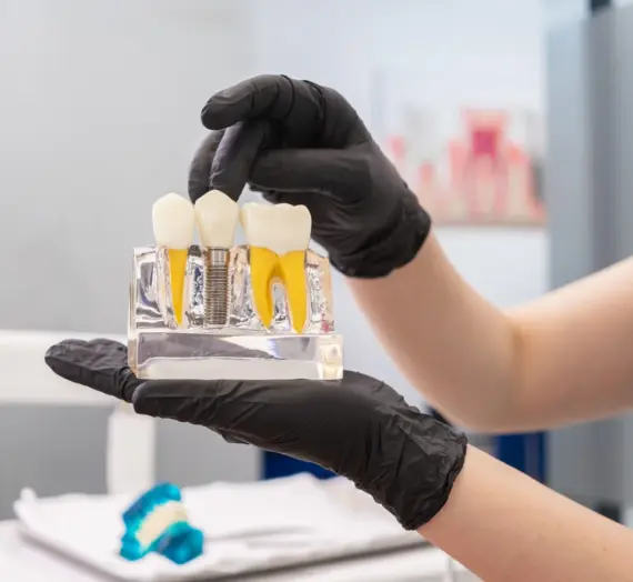 Implanty w jeden dzień Kołobrzeg