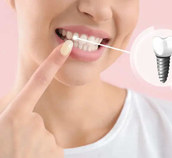 Implanty w jeden dzień Koszalin