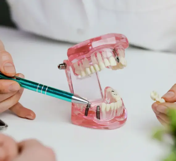 Implanty w jeden dzień Police