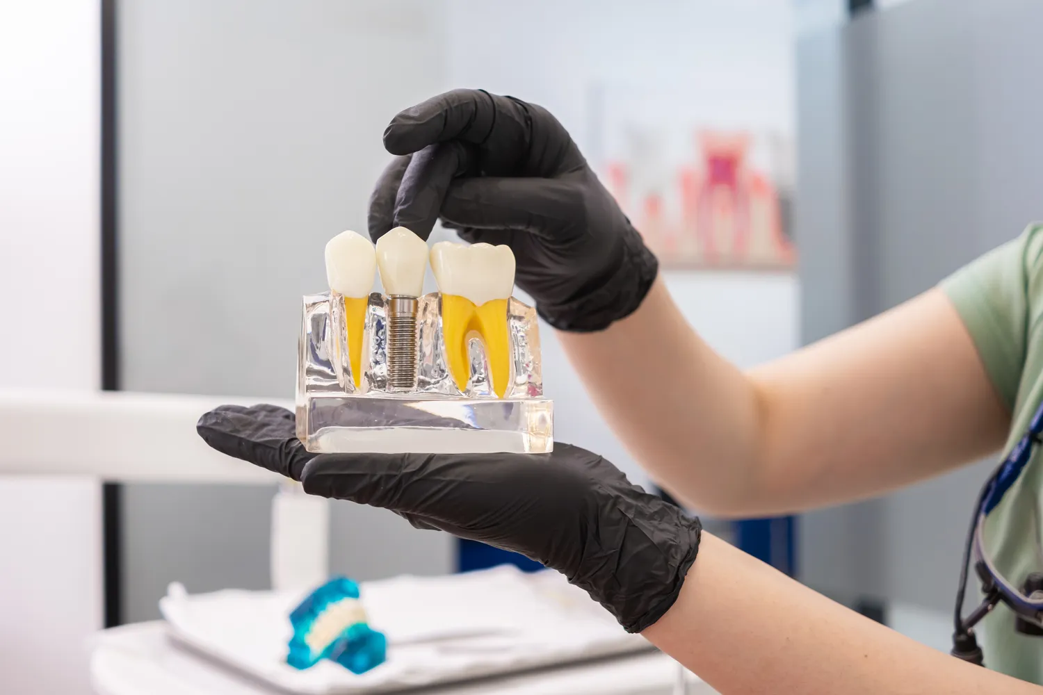 Implanty w jeden dzień Szczecin