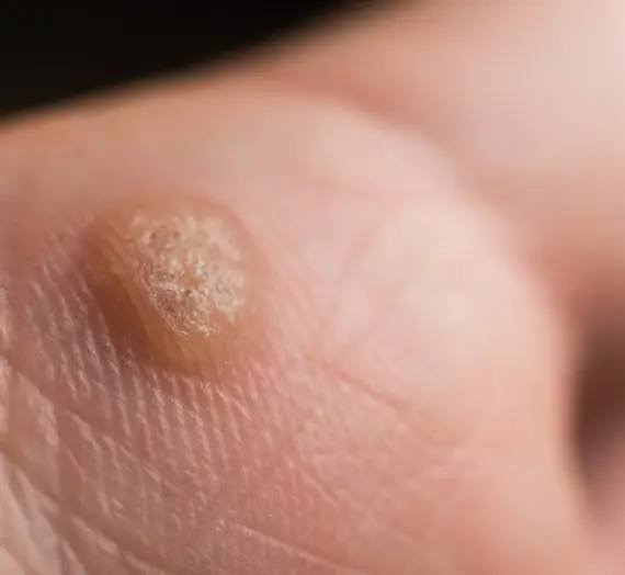 W jaki sposób dobrać okna dachowe na poddasze?