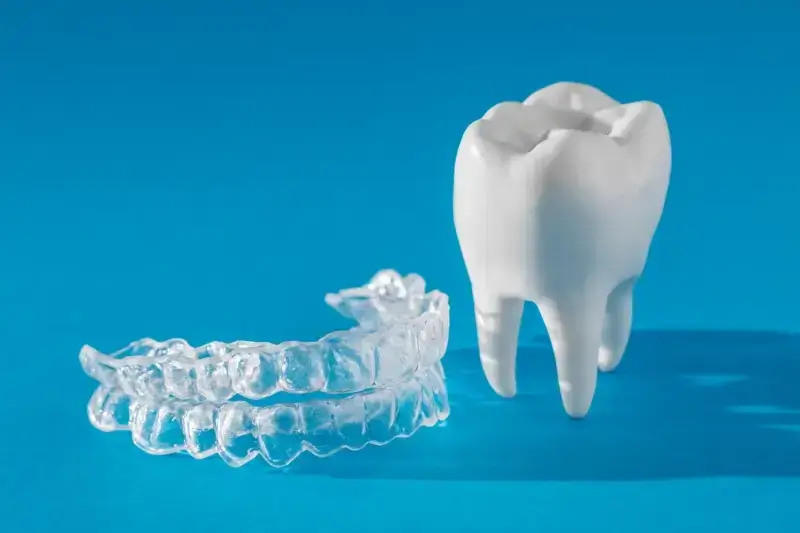 Nakładki Invisalign czy warto?